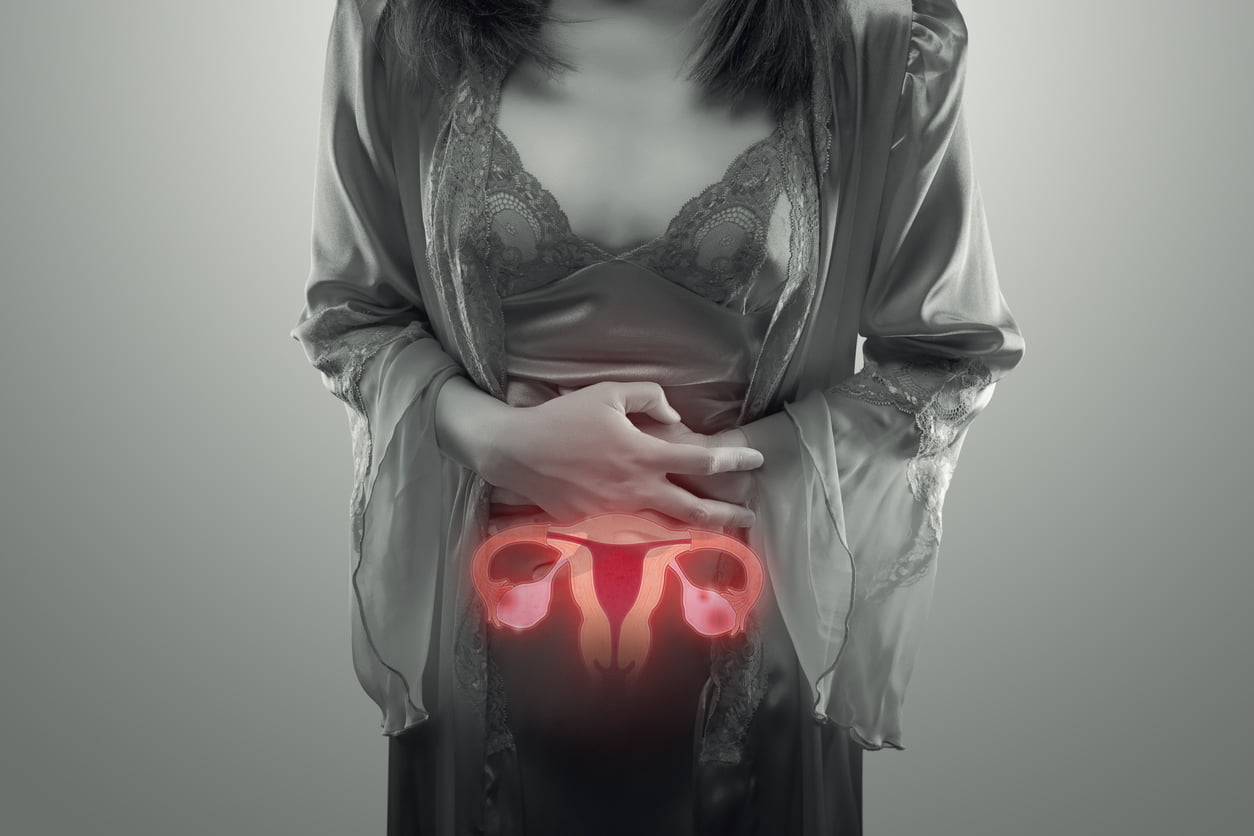 O que é endometriose e como ela pode afetar a fertilidade?