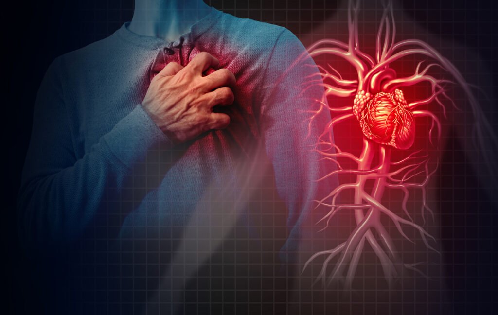 Sintomas De Um Ataque Cardíaco O Que Você Deve Saber