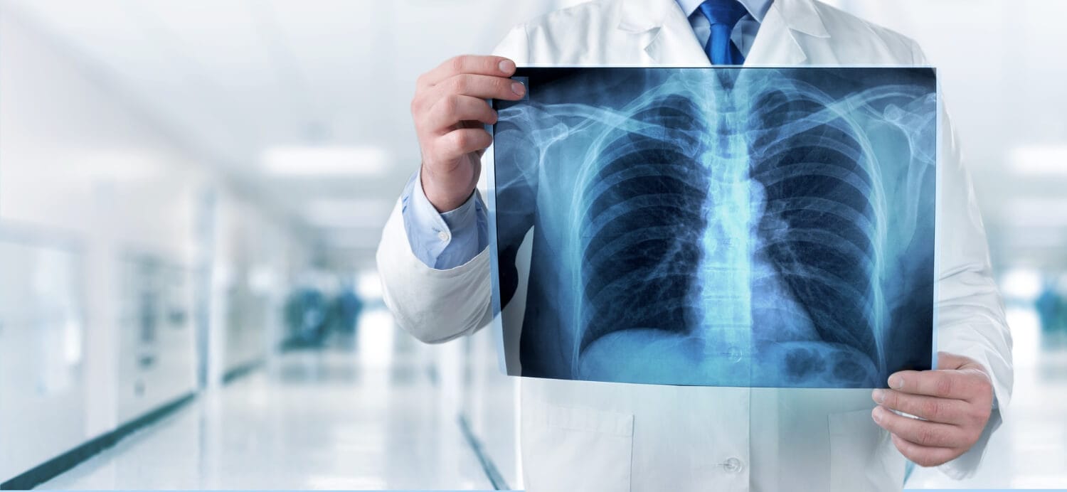 Pneumologista: O Especialista que Cuida da Sua Respiração e Bem-Estar