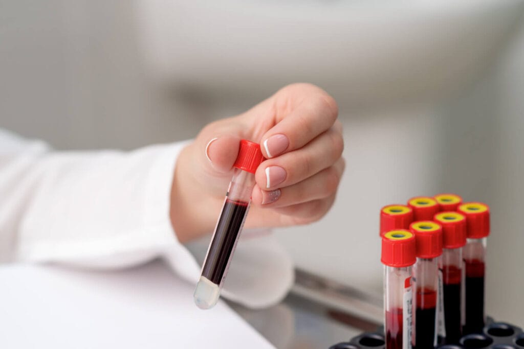 Exames Laboratoriais Essenciais: Como Detectar E Prevenir Doenças Silenciosas 4 Exames Laboratoriais