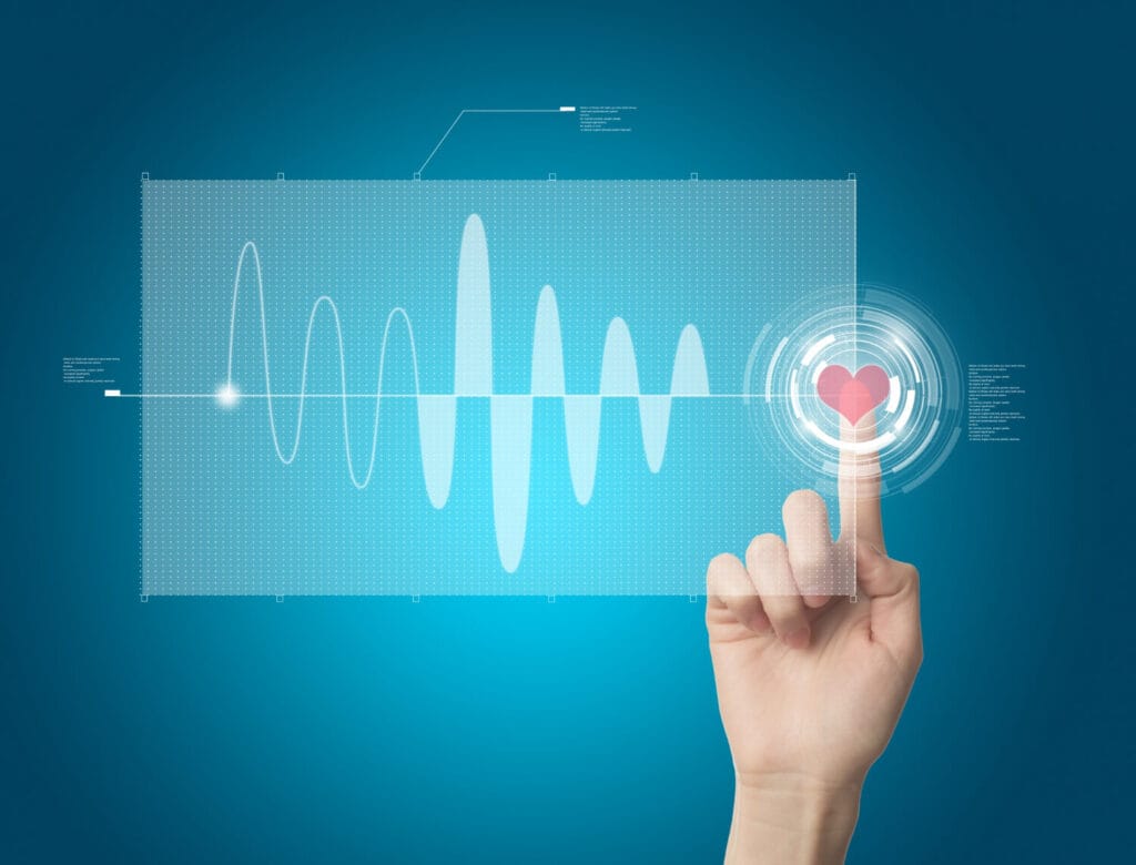Eletrocardiograma: Entendendo Os Resultados Do Seu Coração 3 Eletrocardiograma