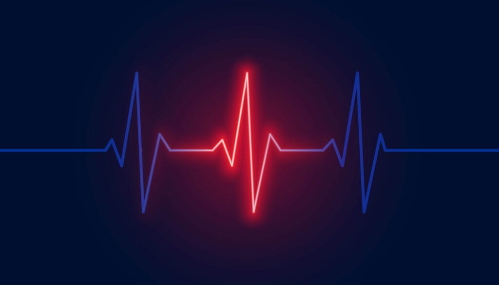 Eletrocardiograma: Entendendo Os Resultados Do Seu Coração 4 Eletrocardiograma
