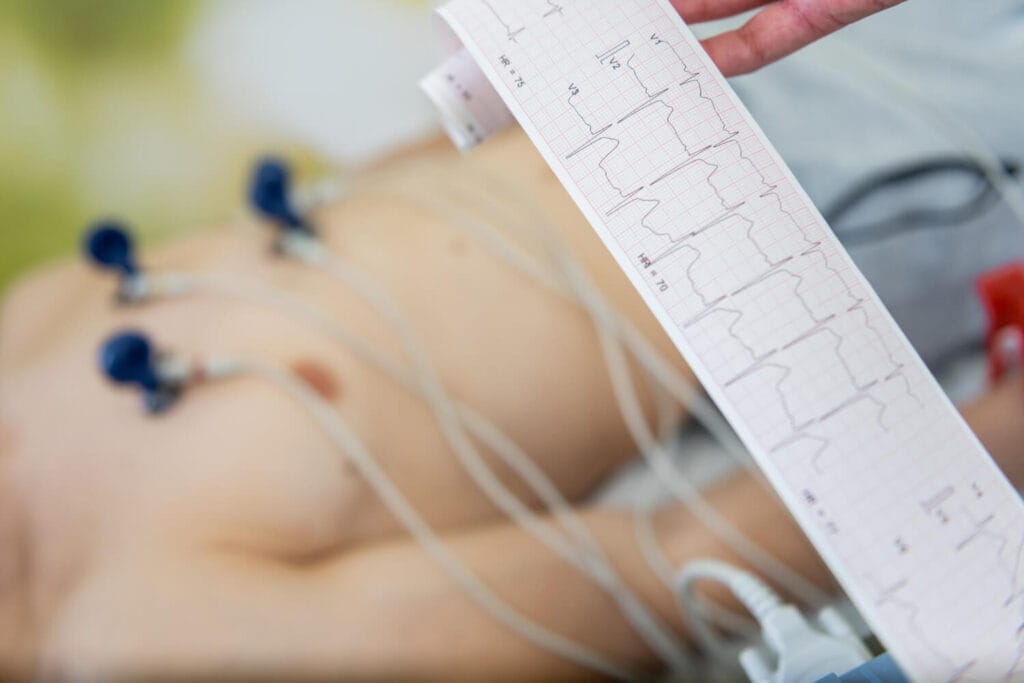 Eletrocardiograma: Entendendo Os Resultados Do Seu Coração 1 Eletrocardiograma