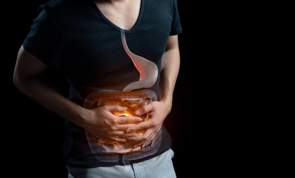 Quando A Azia Frequente Pode Indicar Problemas Gastrointestinais 3 Azia