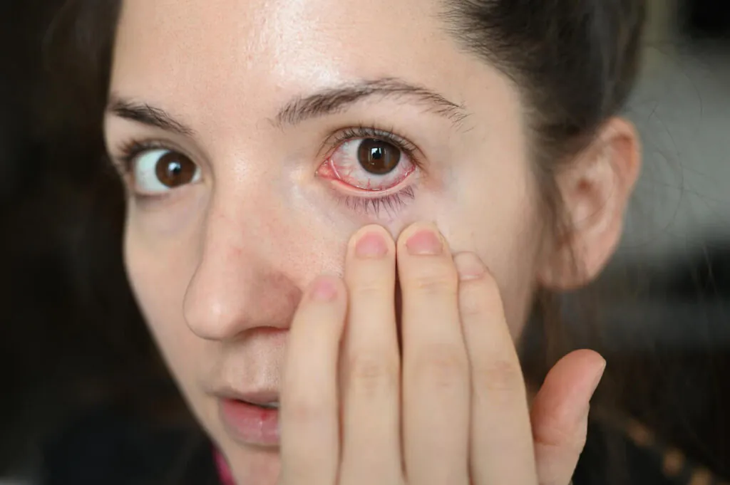 Olhos Vermelhos
