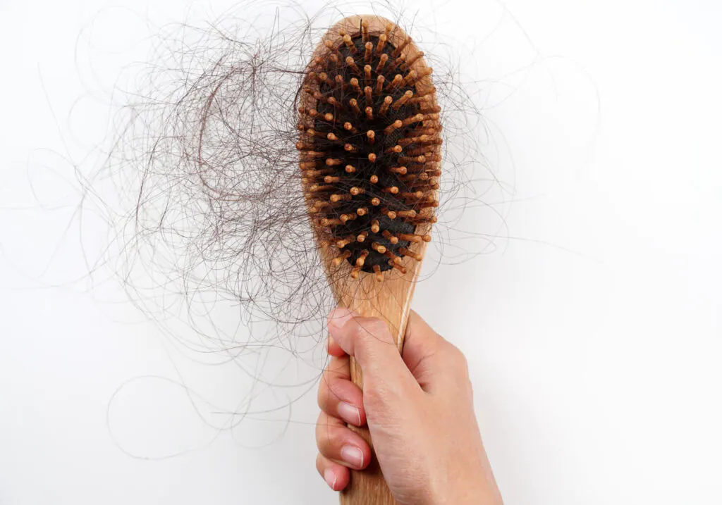 Queda De Cabelo: Quando Investigar Além Dos Cuidados Estéticos? 1 Queda De Cabelo